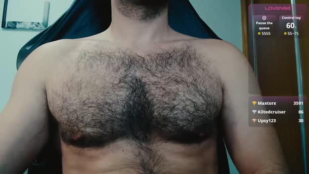 myhairymacho 06-11-2025 video analsex